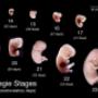 zo groeit een foetus