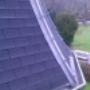Shingles