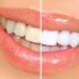 Whitesmile Tandartspraktijk