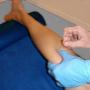 Dry Needling