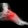Ceelen en Bukkems Orthopedische Schoentechniek vd