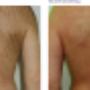 IPL-ontharing