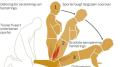 Voorkom hamstringblessures met de Nordic hamstring curl