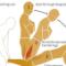 Nordic-hamstring-curl