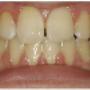 Orthodontie Amersfoort
