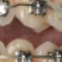 Orthodontie Amersfoort