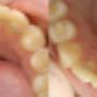Orthodontie Amersfoort