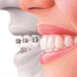 Boxberger tandartsen en orthodontie