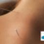 Verheul Fysio- Manuele Therapie & Acupunctuur