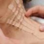 Medical taping