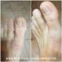 Basic pedicure