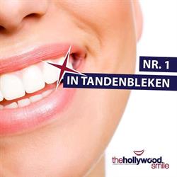 The Hollywood Smile