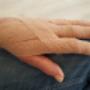 Oedeemtherapie