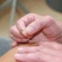 Dry Needling