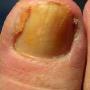Podotherapie Delea