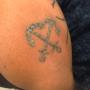 Tattoo verwijdering  -na behandeling-