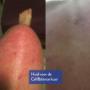 CellBalance