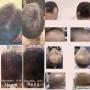 Resultaat na 3 mnd Love y hair