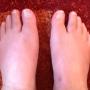 Voetreflextherapie