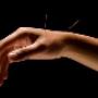 Zeilstra Acupunctuur