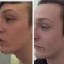 Huidzorg Laserklinieken