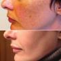 Huidzorg Laserklinieken