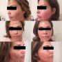Huidzorg Laserklinieken