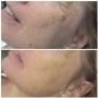 Huidzorg Laserklinieken