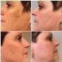 Huidzorg Laserklinieken