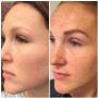 Huidzorg Laserklinieken
