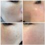 Huidzorg Laserklinieken