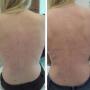 Huidzorg Laserklinieken