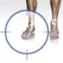 blessure behandeling met licht