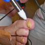 i-health meridiaan diagnostiek