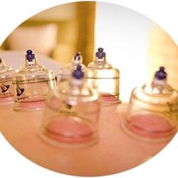 Hijama & Cupping Schiedam