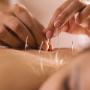 Acupunctuur Eindhoven & Best