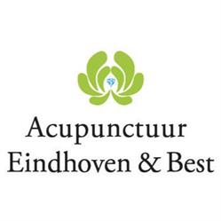 Acupunctuur Eindhoven & Best