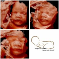 Baby Echo Dordrecht