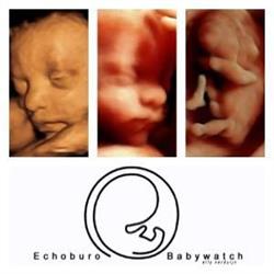 Echoburo Babywatch