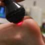 Lasertherapie Nederland