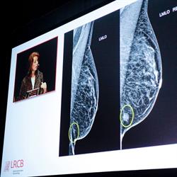 LRCB dutch expert centre for screening