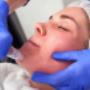 Microneedling / SkinPen |
Huidtherapie Huizen

Wat is Microneedling en de SkinPen?

Microneedling is een effectieve manier om de huid in de diepte te vernieuwen en te verbeteren. Wij maken gebruik van de Skinpen. De SkinPen behandeling is een medische microneedling behandeling om de huid in de diepte te vernieuwen en te verbeteren. Door middel van kleine, steriele naaldjes worden zuivere microkanaaltjes in de huid gemaakt waardoor het huideigen wondgenezingsproces wordt aangezet. Hiermee wordt de aanmaak van collageen en elastine gestimuleerd. Collageen zorgt voor volume en stevigheid van de huid, terwijl elastine zorgt voor de veerkracht van de huid.