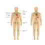 Manuele lymfdrainage |
Huidtherapie Huizen

Wat is manuele lymfdrainage?

Ons lymfstelsel: Naast een bloedvatenstelsel heeft het menselijk lichaam ook een lymfvatenstelsel. Het lymfevocht (met afvalstoffen) wordt door de lymfevaten teruggevoerd naar het bloed. De lymfevaten passeren hierbij vele lymfeklieren. In de lymfeklieren zitten witte bloed-cellen die eventuele ziekteverwekkers (bacteriën en schimmels) kunnen opruimen.