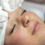 Acnetherapie | Huidtherapie Huizen

Wat is acnetherapie?

Acnetherapie is de behandeling van acne. Acne is het ontstaan van puistjes, mee-eters of cysten. Dit komt sneller voor op een vette huid en wordt veroorzaakt door een bacterie, de p. acnes bacterie. Het doel van een acnebehandeling is dat de acne vermindert of zelfs weg gaat en je de kans op littekenvorming vermindert. Er zijn verschillende behandelmethodes die ervoor zorgen een mooi resultaat te halen.