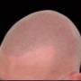 # 3