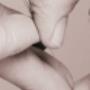 Acupunctuur