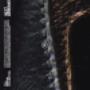 # 14