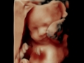 4D pretecho